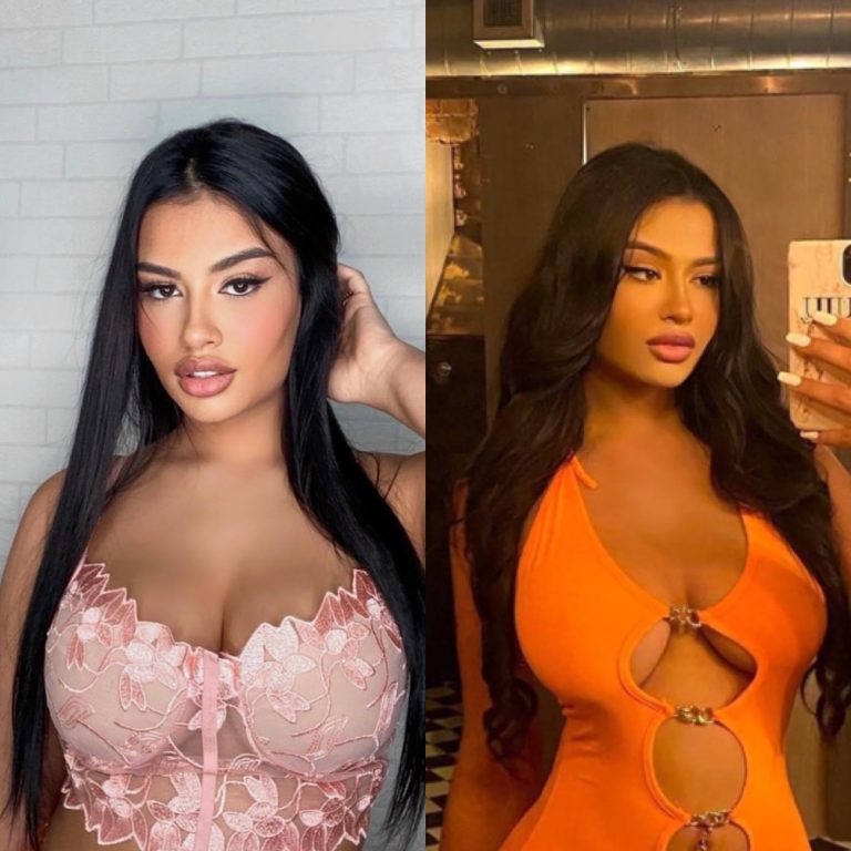 <strong><em>Influencer Who Gained Reputation On The Internet As A Look-Alike Of Kylie Jenner Reveals That She Had A Facelift At Age 21</em></strong>